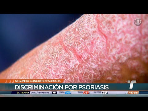 Realizarán en Panamá el Segundo Congreso Nacional de Psoriasis y Artritis Psoriásica