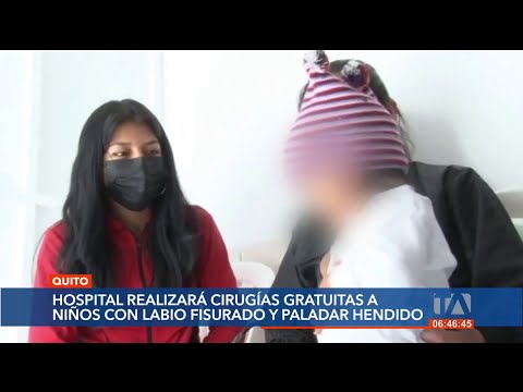 40 niños se beneficiarán de cirugías de labio fisurado gratuitas en un hospital de Quito