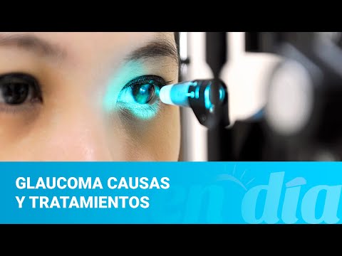 Glaucoma causas y tratamientos
