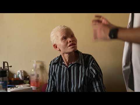 Dermatólogos internacionales ayudan a tratar el cáncer de piel de personas albinas en Mozambiqu