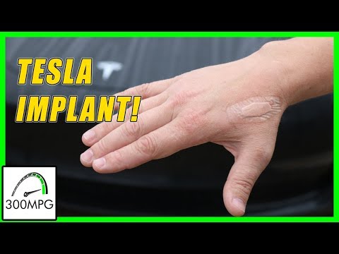 Tesla key-card Implant! | Why and How?