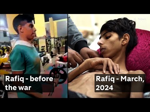 Israel Gaza: teens trapped in Al-Shifa hospital with no food