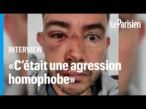 Lyon : Quentin raconte son agression à la sortie d'un bar LGBT