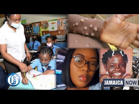 JAMAICA NOW: Mask mandate to be re-imposed | Chang & Samuda COVID positive | Monkeypox virus alert