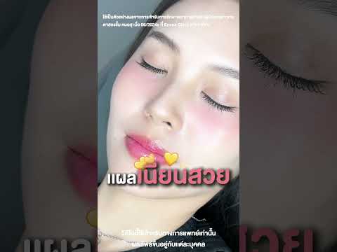 รีวิวตาสองชั้นทำตาสองชั้นตาส