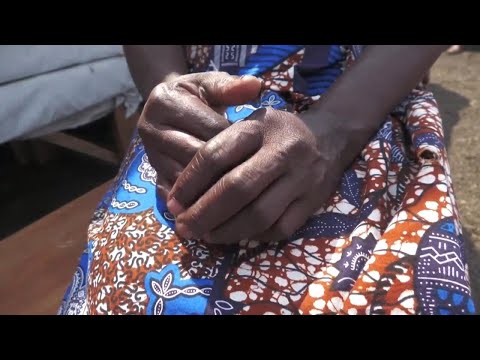 Surging conflict in DRCongo drives sexual assault against displaced women