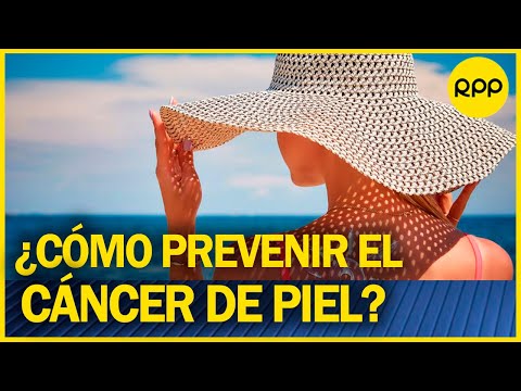 Alberto Pajuelo: “la principal causa de cáncer de piel es la radiación solar”
