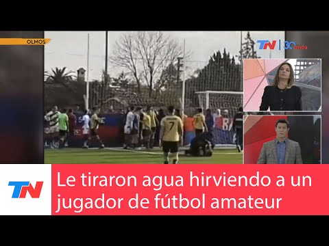 OTRO ATAQUE EN EL FÚTBOL: Le tiraron agua hirviendo en la cara a un jugador de Porteño de Ensenada