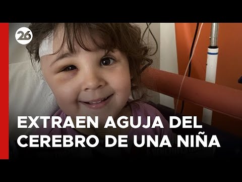 ESPAÑA | Extraen una aguja clavada en el cerebro de una niña de 4 años