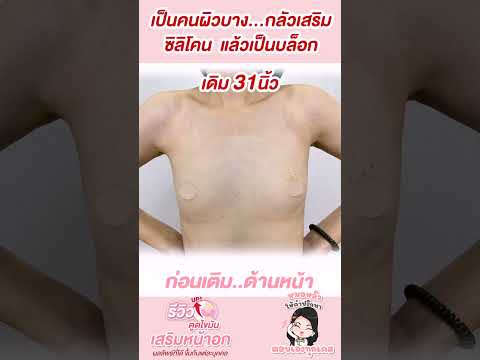 เดิมเป็นคนผิวบางกลัวเสริมซิลิ