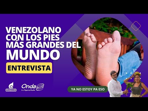 VIDEO: Regalan zapatos al venezolano con los pies más grandes del mundo