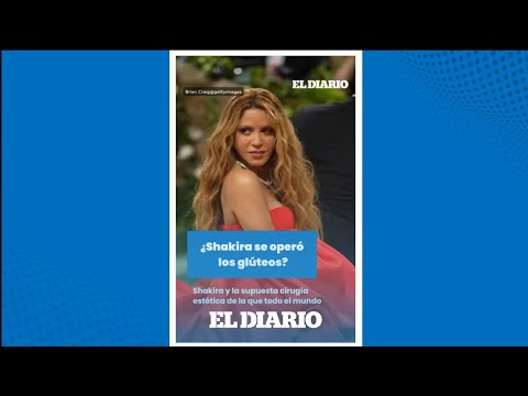 ¿Shakira se sometió al bisturí? | El Diario