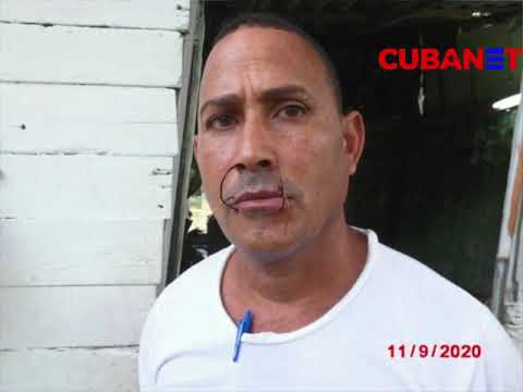 Cubano se cose la boca y entra en huelga de hambre como forma de protesta