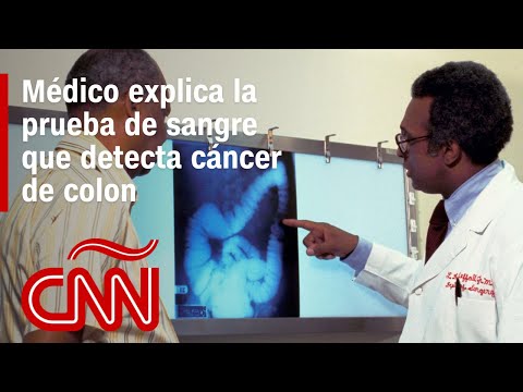 Médico explica cómo funciona la prueba de sangre que detecta el cáncer de colon