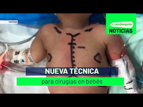 Nueva técnica para cirugías en bebés - Teleantioquia Noticias