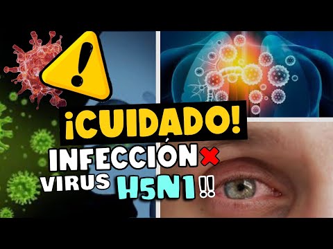 ¡CUIDADO! INFECCIÓN POR VIRUS H5N1- ¿PRÓXIMA PANDEMIA?