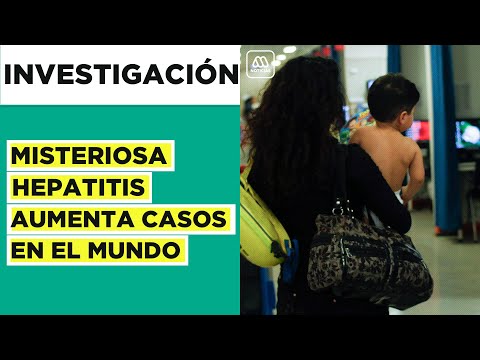 Misteriosa hepatitis infantil: Un niño fallecido y 17 trasplantados