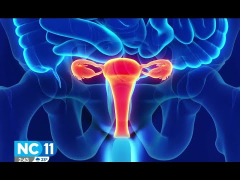 Causas y síntomas del cáncer de endometrio