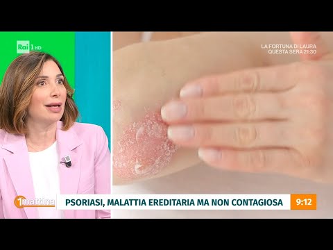 La psoriasi - Unomattina - 04/04/2024