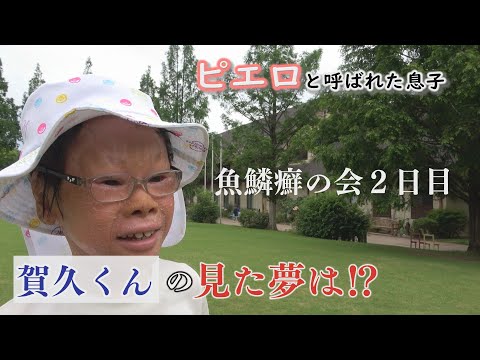 【最新話】魚鱗癬の会でピアノ演奏♪「がんばろう。がく」テーマソング～配信型ドキュメンタリー「ピエロと呼ばれた息子」第１３７話