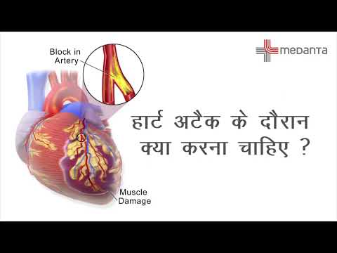 दिल का दौरा पड़ने (हार्ट अटैक) पर क्या करें | डॉक्टर प्रमोद कुमार