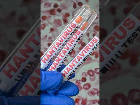 Do We Need a Hantavirus Vaccine?