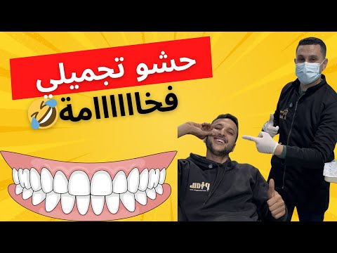 حشو تجميلي لناب علوي 