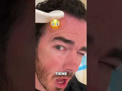 ¡#KevinJonas, de los #JonasBrothers, revela que tiene ca?ncer de piel!