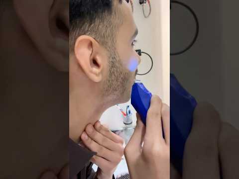 اخر شي نشبت في ذقنة 🤣 #اكسبلور #فورد #مقالب #مقلب #ضحك #وناسة #فوردات