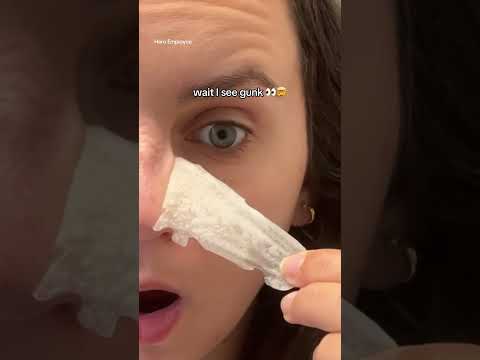 Does Mighty Patch™ Nose Patch ACTUALLY work??