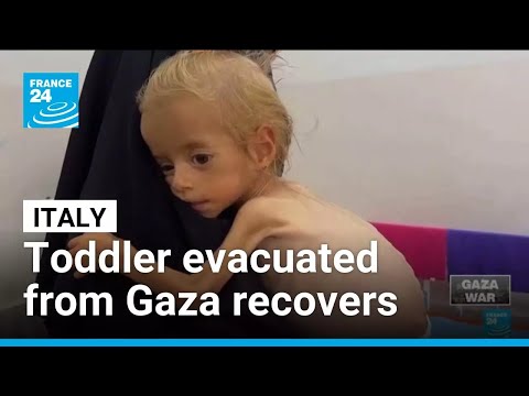Toddler evacuated from Gaza recovers from malnutrition in Italian hospital • FRANCE 24 English