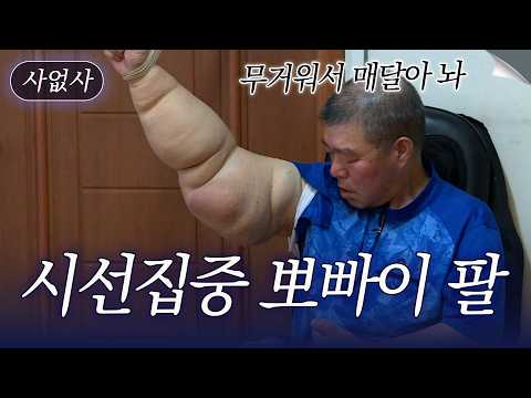 <strong>뽀빠이</strong> 팔을 가진 남자의 슬픈 사연｜특종세상 사없사 321회
