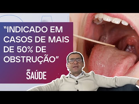 O avanço da cirurgia de amígdalas e adenóides em crianças | Dr. Salomão Carui