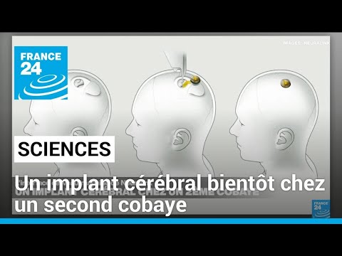 Neuralink : un implant cérébral bientôt chez un second cobaye • FRANCE 24