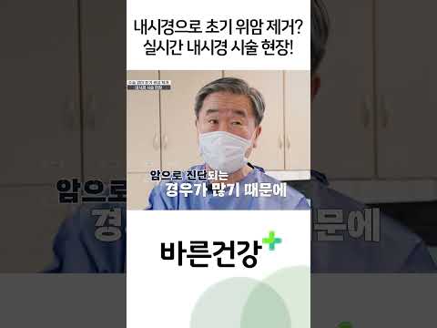 내시경으로 <strong>초기</strong> <strong>위암</strong> 제거! 실시간 내시경 시술 현장