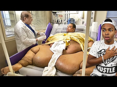 the world's fattest man..