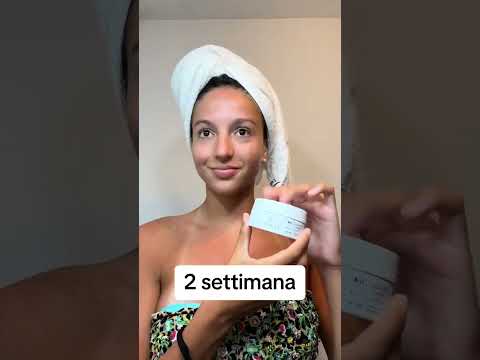 Acne: risultati prima e dopo Jasmine