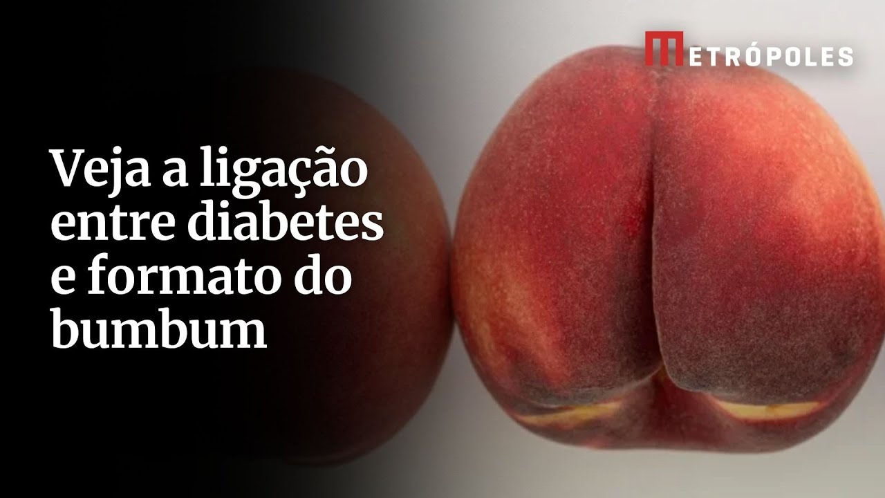 Formato do bumbum pode revelar risco de diabetes? Entenda o estudo