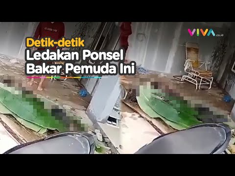 Tragis! Ponsel Meledak, Seorang Pemuda terbakar saat Tidur.