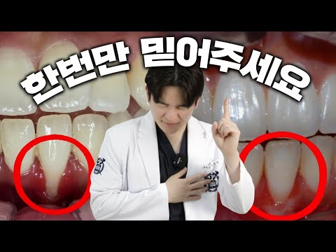 진짜 안아프다니까요..!!ㅣ잇몸재건술 실제사례