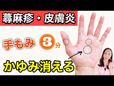 蕁麻疹・アレルギー性皮膚炎の救世主！今すぐ試せる手のツボ3選！