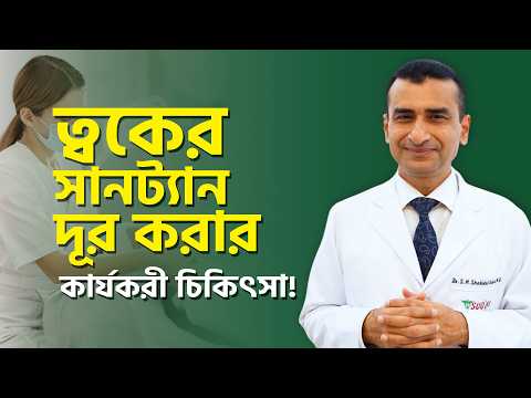Best Suntan Removal Treatment খুঁজছেন? - জানুন বিস্তারিত সানট্যান দূর করার উপায়