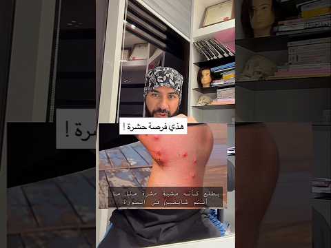 حالة جلدية منتشرة