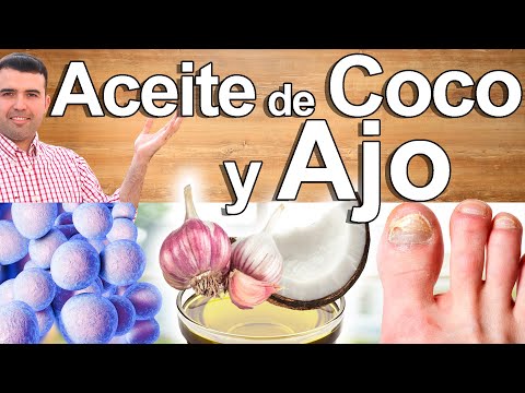 Aceite De Coco Y Ajo En Casa - Para Qué Sirve - Cómo Prepararlo Para Tu Salud Y Belleza