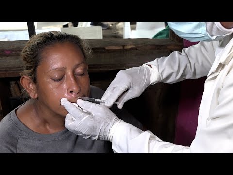 Habitantes de Ciudad Belén reciben cuidado de la piel en jornada de salud