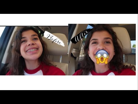 GETTING MY BRACES OFF...