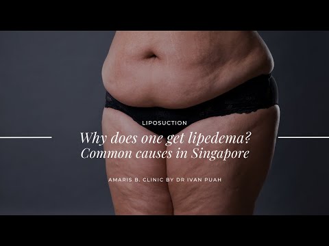 Why does one get lipedema? Common causes in Singapore | Amaris B. Clinic by Dr Ivan Puah