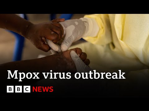 Sweden confirms first case of new mpox variant | BBC News