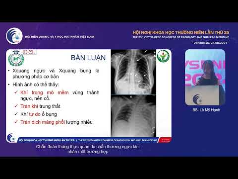 7. Chẩn đoán thủng thực quản do chấn thương ngực kín: nhân một trường hợp (BS. Lê Mỹ Hạnh)