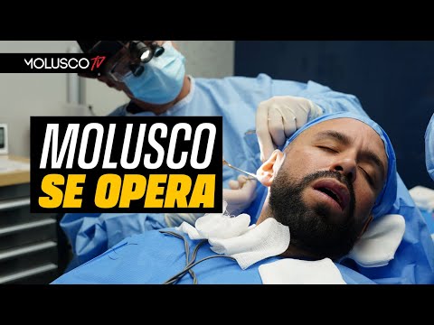 Molusco se juega la vida en el quirófano. OPERACION COMPLETA